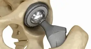 سنگ تیتانیوم-چگالی تیتانیوم-ورق تیتانیوم-قیمت تیتانیوم-قیمت هر کیلو تیتانیوم