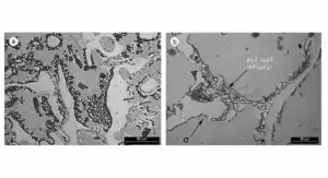 استیل پایدار شده